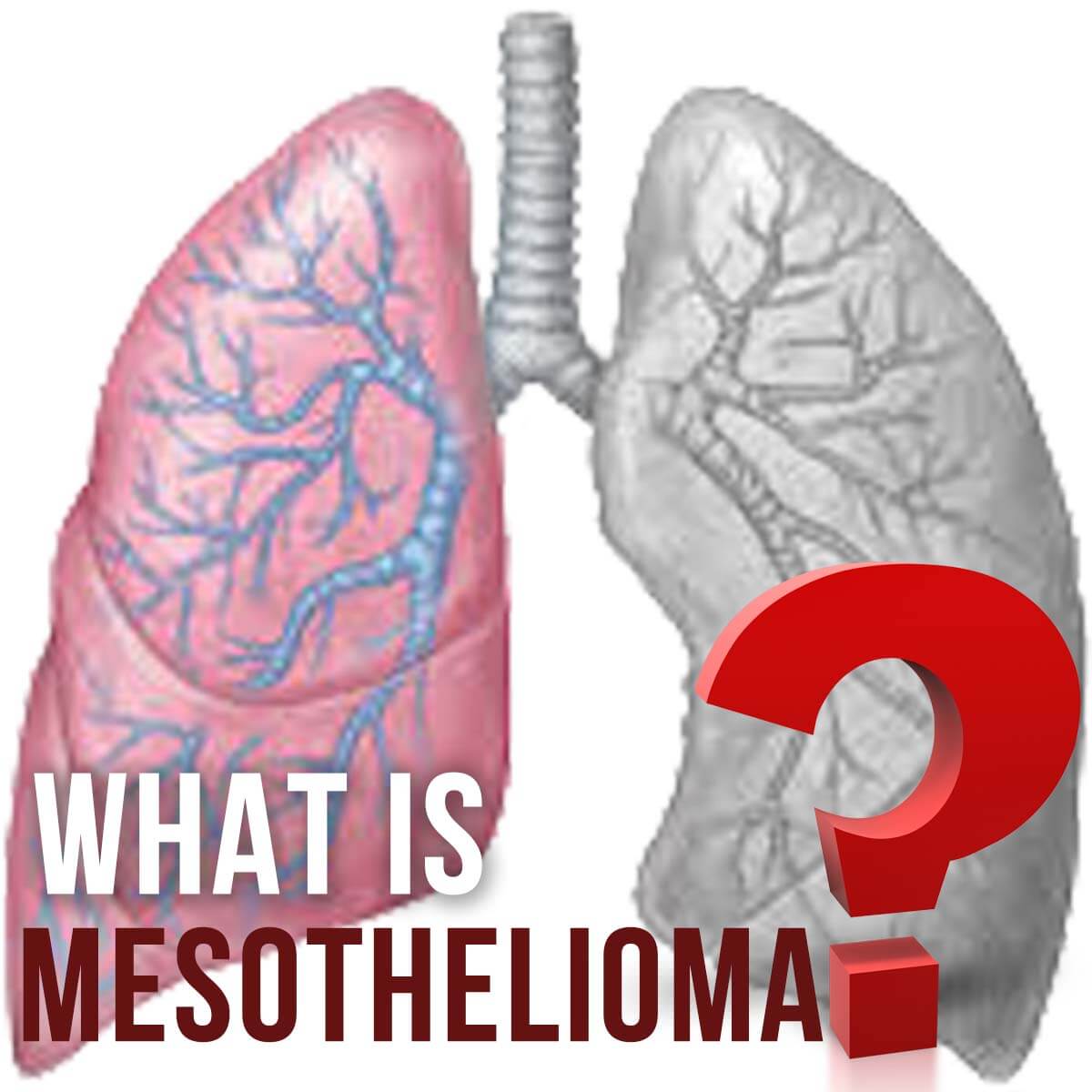 Mesothelioma Lawyer - Connect With An Attorney Today
